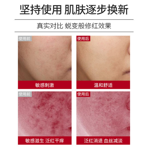 Centella asiatica repair cream removes redness, thickens cuticles, repairs sensitive muscles, hormones, face repair cream, beauty salon