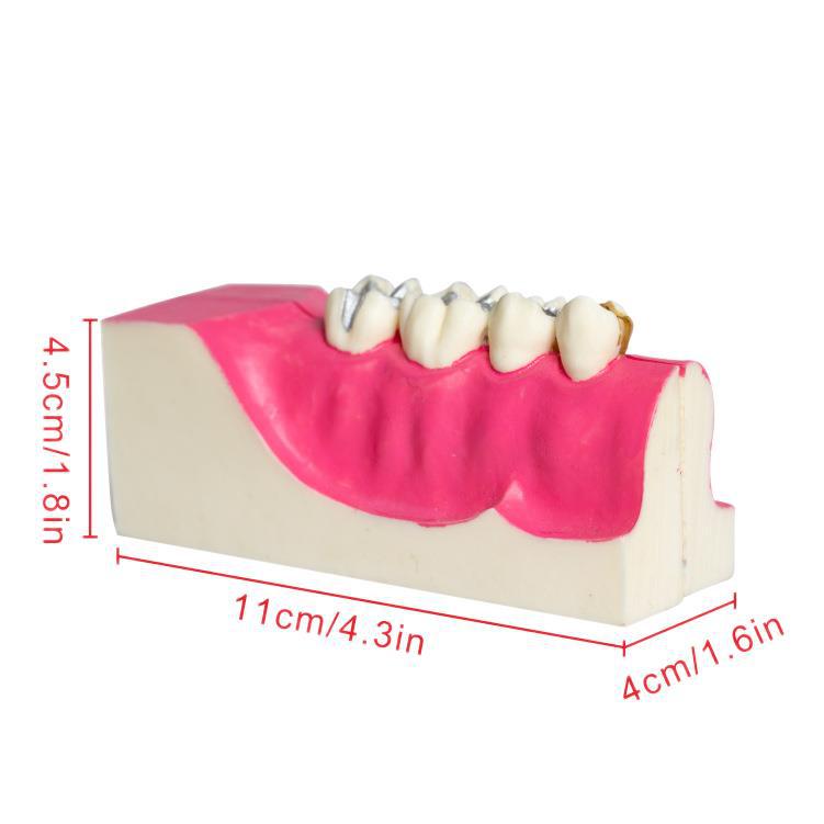 Modelo de descomposición del tejido del diente posterior inferior derecho de la cavidad oral del diente