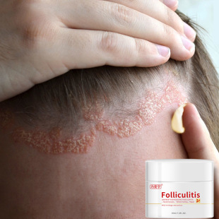 ���ˌ���֬��Ƥ�׸��^���������W�^Ƥ�_���oֹ�W���S��