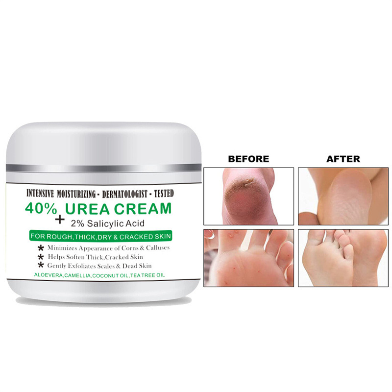 Ενυδατική κρέμα χεριών Crazylife Urea 100g για ξηρά, σκασμένα πόδια και φτέρνες_voghion.com
