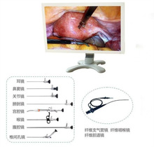 内窥镜摄像系统 原生高清 国产腹腔镜宫腔镜关节镜膀胱镜