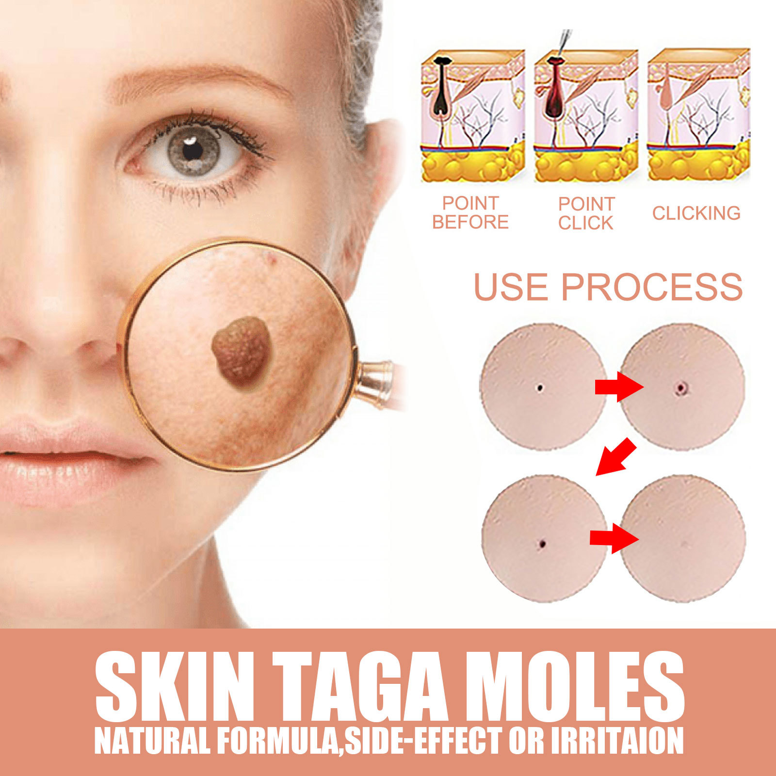 EELHOE for skin repair, body care, hands, feet, face, and underarm wart cream_voghion.com