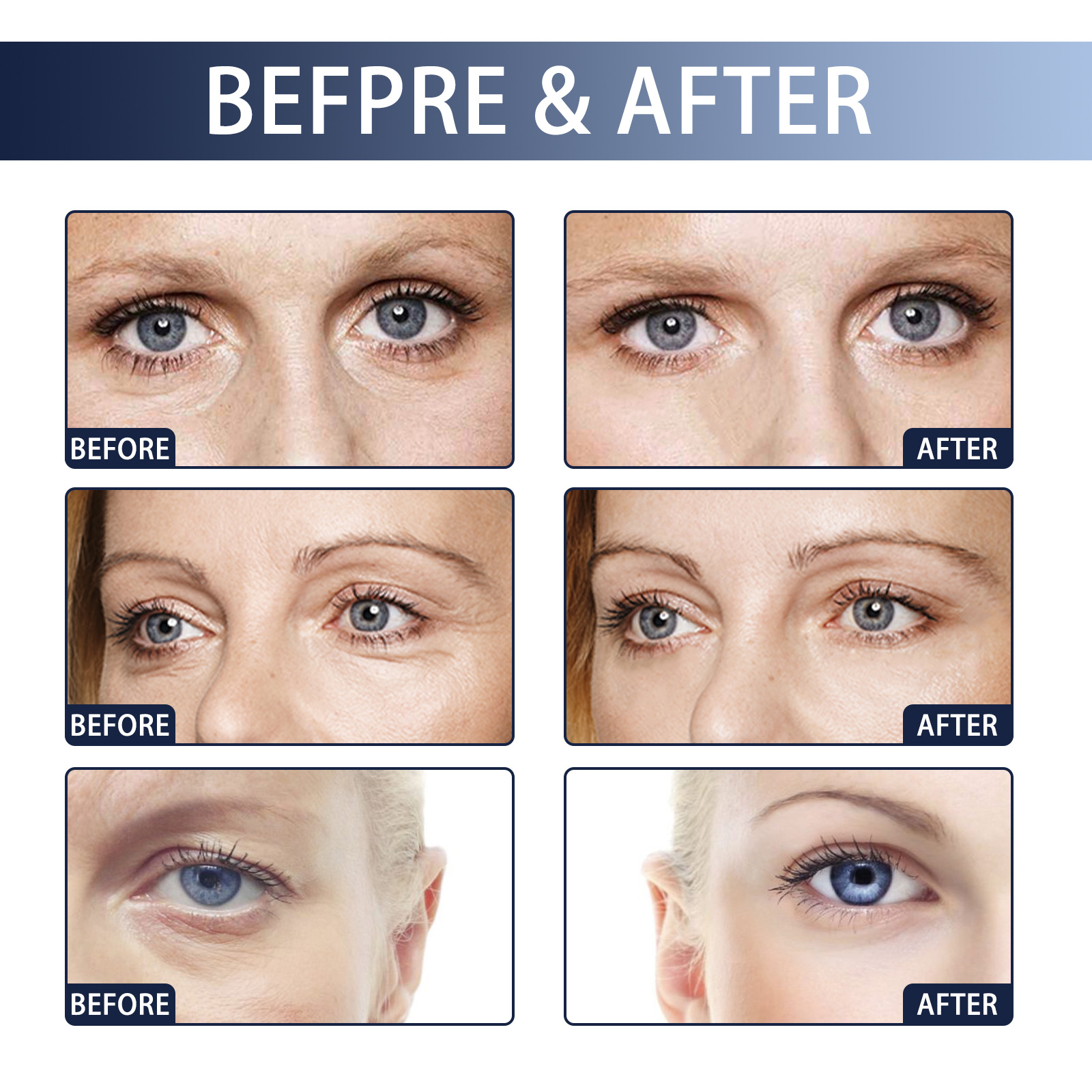 Rimpel Jaysuing Instant Resisting Eye Lifts, Sparren, Vervaagt Hoeken, Fijne Lijntjes, Reparaties en Hydrateert Anti A_voghion.com