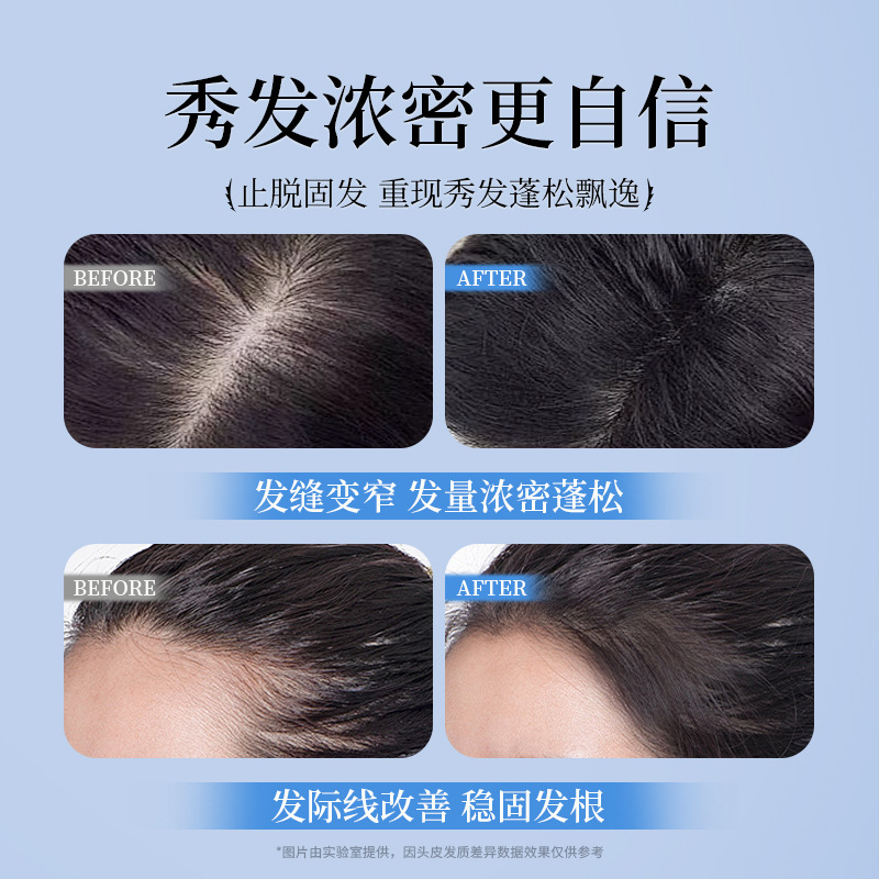 倾龄防脱固发洗发水蓬松控油补水滋养强韧发根去屑洗发液|undefined