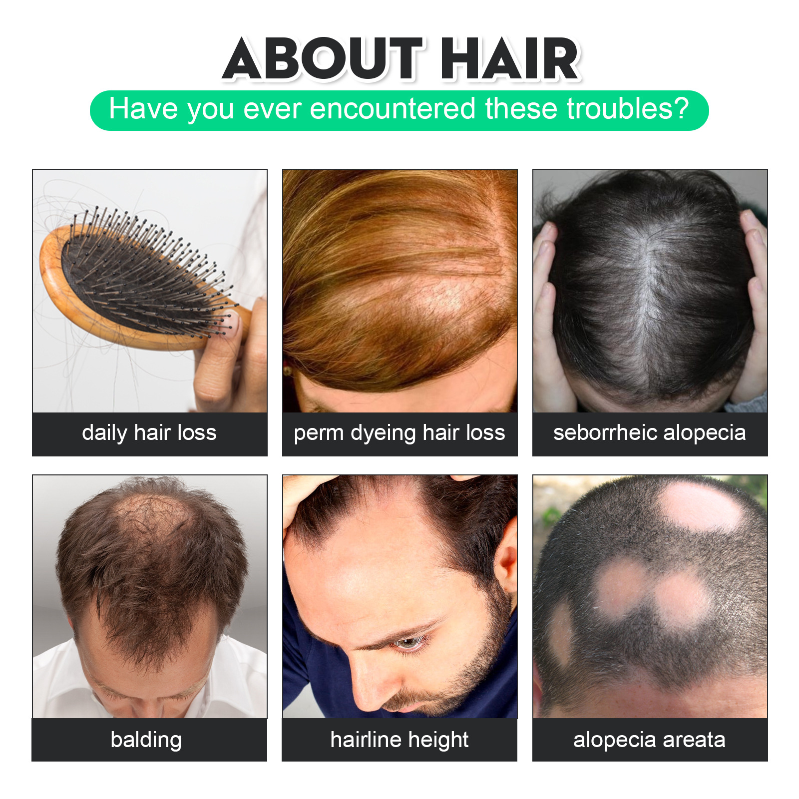 Soluzione nutriente per la crescita dei capelli da uomo: formula nutriente per capelli più spessi e folti_voghion.com