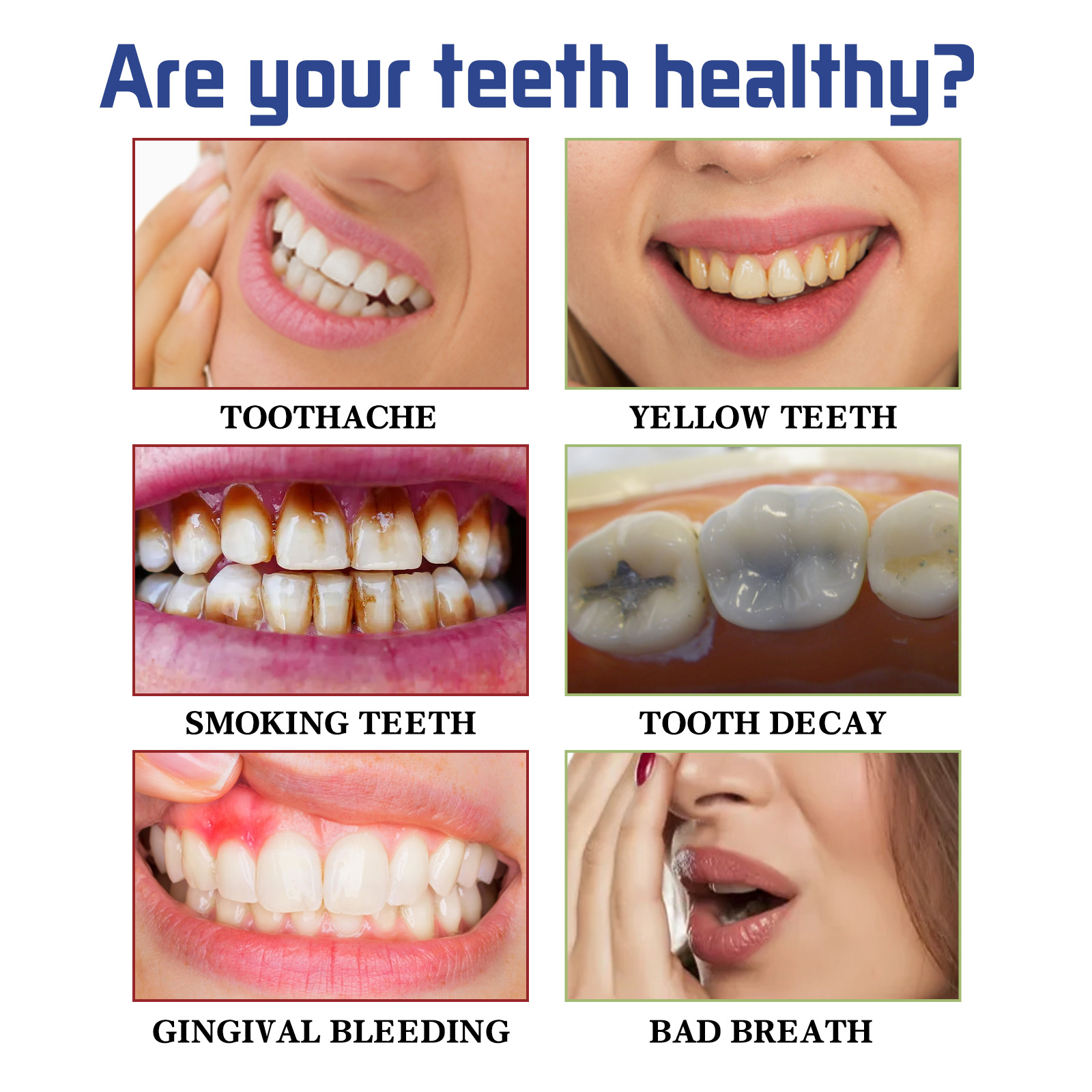 OUHOE Tooth Mousse Pulizia orale Denti gialli, alito cattivo, tartaro, macchie, dentifricio in schiuma antitarme_voghion.com