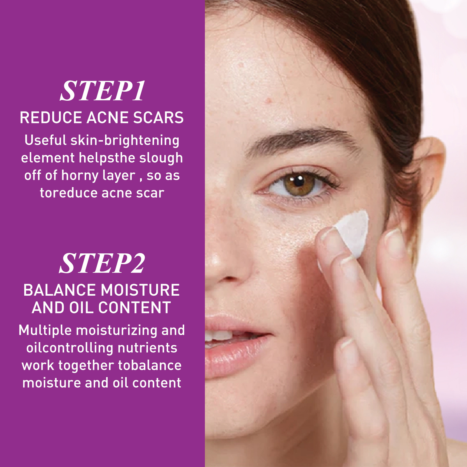 EELHOE Spot Lightening Whitening Cream mindert Akneflecken, repariert dunkle Flecken, spendet Feuchtigkeit, festigt und verbessert die Haut_voghion.com