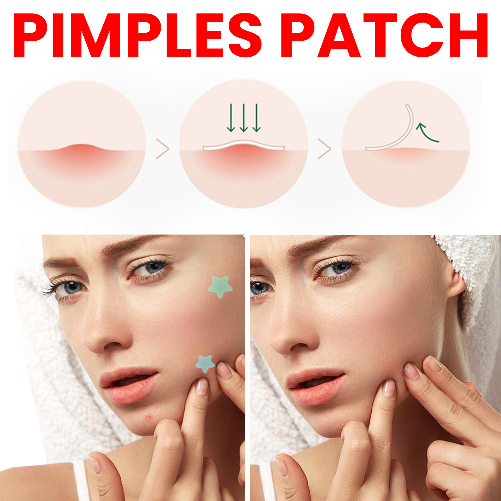 Jaysuing patch to lighten marks, closed mouth blemishes, cover and acne repair patches_voghion.com