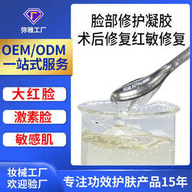 修复冰晶凝胶退红去大红脸芦荟胶 OEM晒后修护激素脸面部护肤凝胶