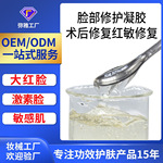 修复冰晶凝胶退红去大红脸芦荟胶 OEM晒后修护激素脸面部护肤凝胶