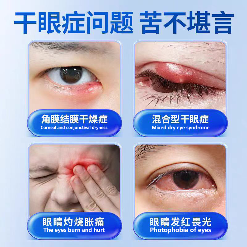 北京銅仁堂のドライアイ用特別点眼液は、目の疲れ、ドライアイ、かすみ目、視力低下を和らげます。|undefined