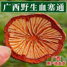 Ұ��Ѫ��ͨ�����XѪͨ����Ѫ�ټt��ѪͨƬ�ݾ��ݲ���ș��