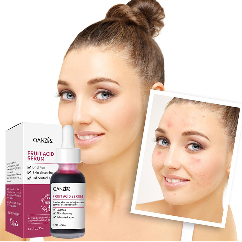 Uebst Säure Essenz, fein Poren, propper Haut, hellen Toun, erweicht Cutin, Hautfleeg Essenz_voghion.com