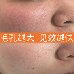 毛穴収縮クリームは毛穴の粗大を修復して口を閉じます。