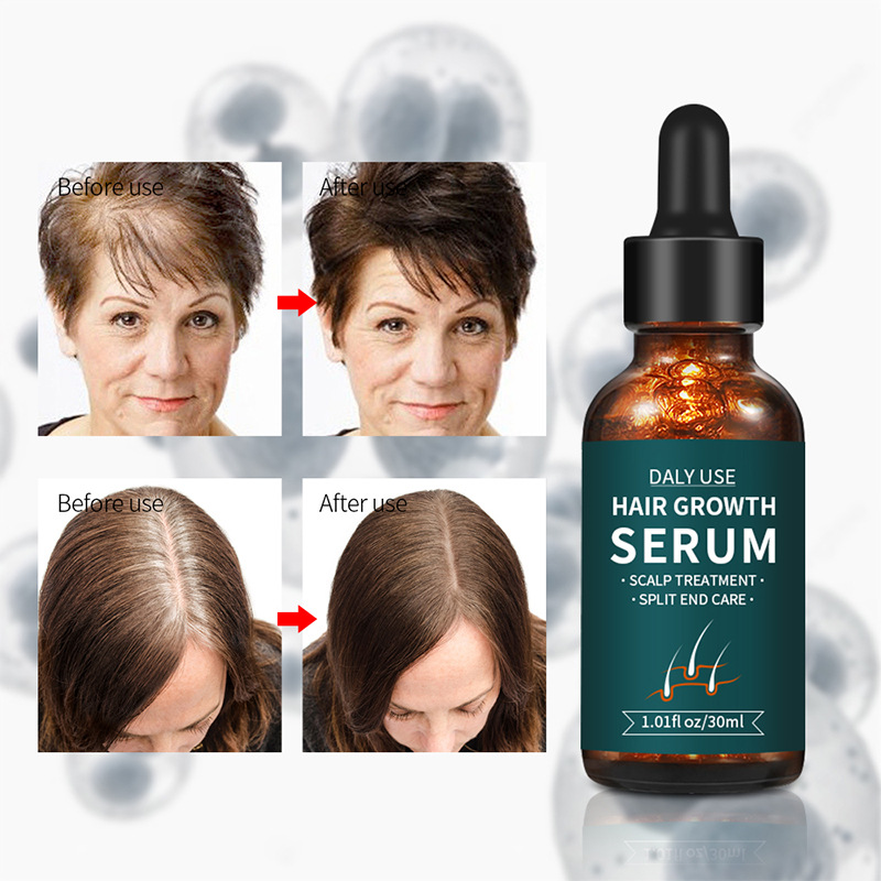 HAIR GROWTH SERUM soluzione per la cura dei capelli_voghion.com