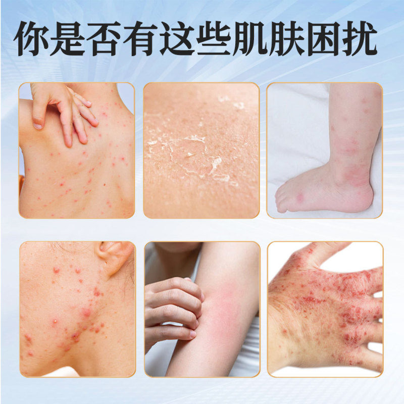 硫黄軟膏皮膚外用男女通用かゆみ止めクリーム50グラム大容量硫黄軟膏クリームメーカー卸売り|undefined