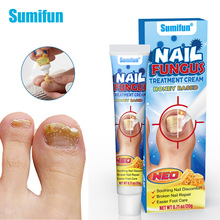 sumifun�羳ר��ָ�׸� ����˹�г� ��ָ�������Ѽ�����K910003