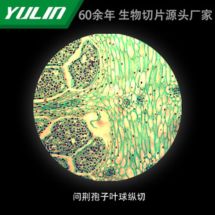 Wenjing Spores, Leaf Balls, Colleges and Universities, Tissue Diseases, Marble Wax Slides, Specimen Microscope