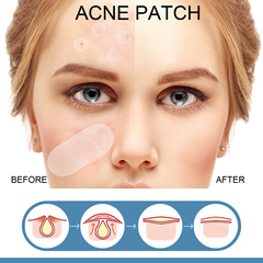 EELHOE Pimple Patch Makeup-Grade 80 Patches Pore Minimizing & Acne Covering Water-Resistant Concealer