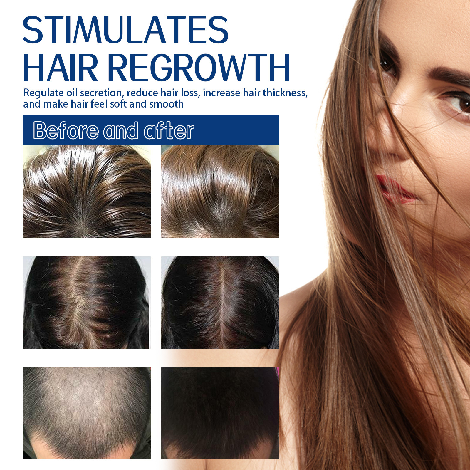 EELHOE Haarpeeling-Reinigungscreme gegen Schuppen auf der Kopfhaut, lindert Juckreiz, flauschiges, feuchtigkeitsspendendes, dichtes Haar, Haare_voghion.com