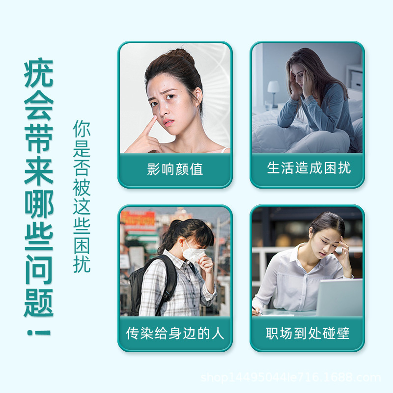 葵.花肤用型造口皮肤保护剂20g/支支持代发批发|undefined