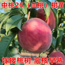 �޽�Ѫ�Ҙ���������Ʒ�N�x�����Ә���޽Ӽt���S��ˮ�������Ե���