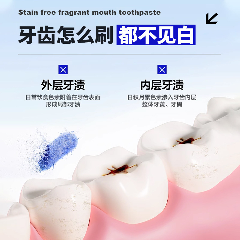特一美白去渍牙膏去烟渍牙渍口臭维护口腔健康改善口腔异味牙膏|undefined