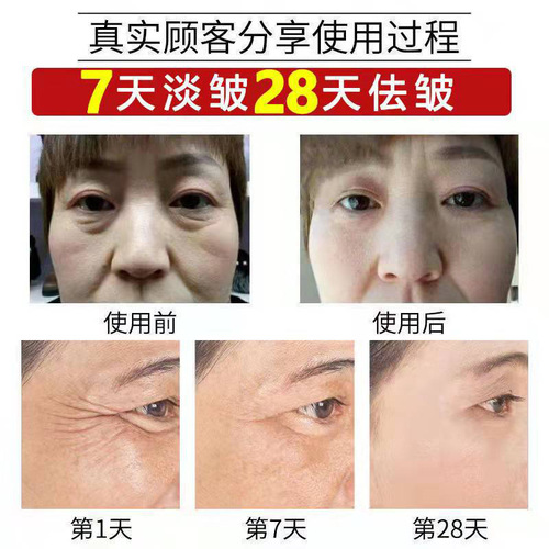 Collagen Filling Cream Wrinkle Firming Cream Repairing Moisturizing Anti-Wrinkle Rejuvenating Cream Collagen Restructuring Cream