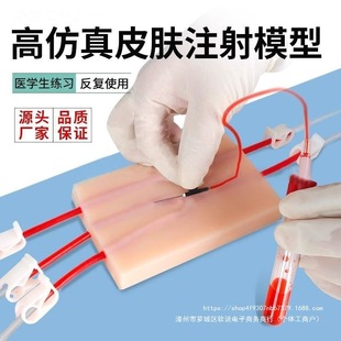 Ƥ�w��Ѫ��Ѫ�����t�W���oʿ���ݔҺY���o�}ע�䴩��ģ�Ͱ�