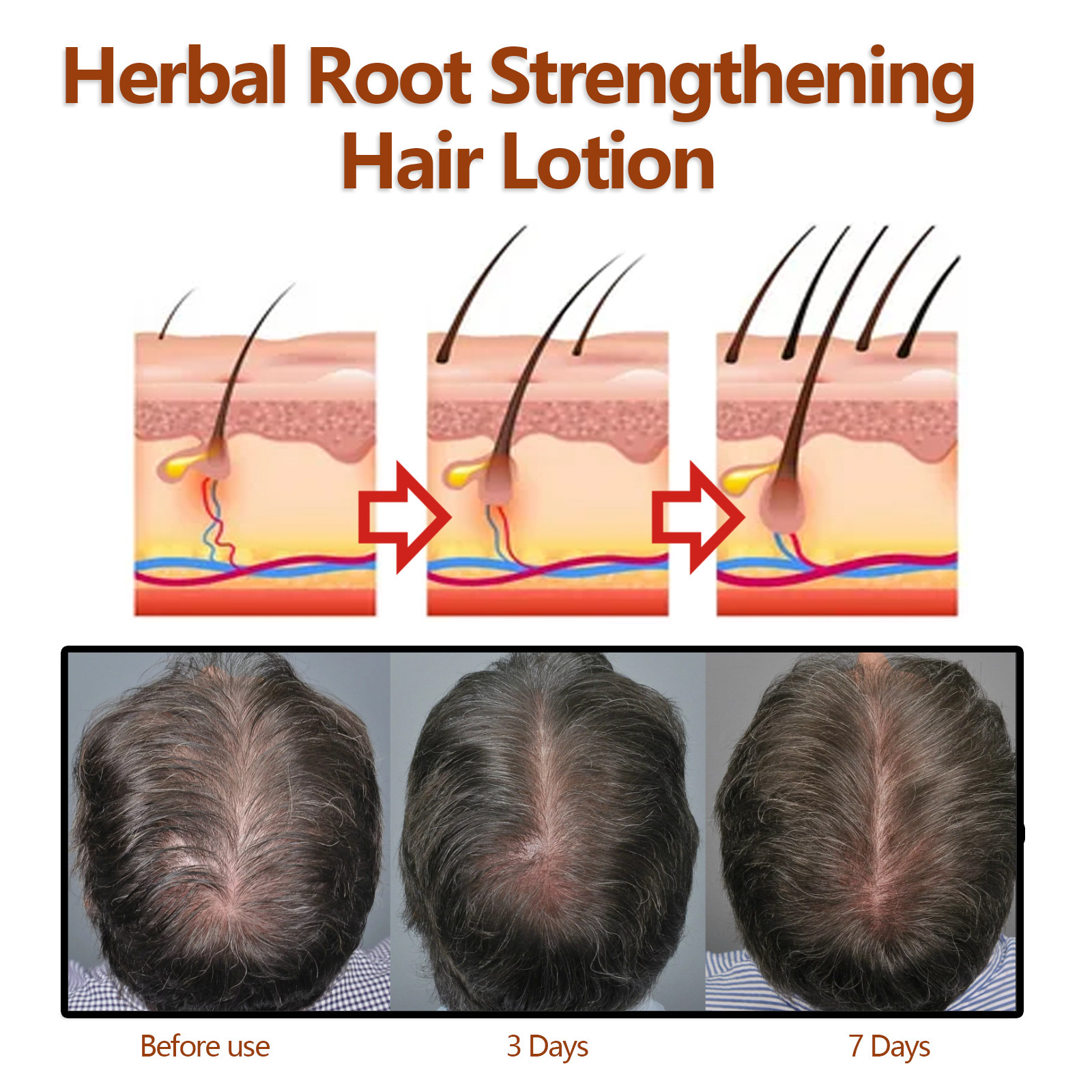 EELHOE zeliščni losjon za lase od korenin učvrsti in obnovi debelo lasno linijo, krepi lase, vlaži lase in preprečuje izpadanje las_voghion.com
