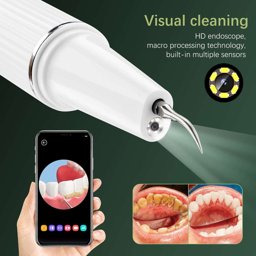Ultrasonic Toothbrush Image 4
