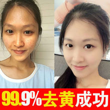 �۲�����׃��Ę��ȥ�S����ư��S�����wɫ�o�wƷ�沿�r���ؾ��AҺ