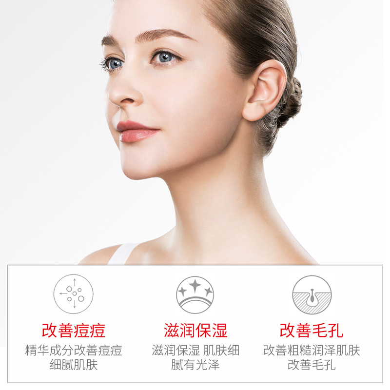 Suero Facial Anti-Acné Hidratante para Cuidado Facial image 4