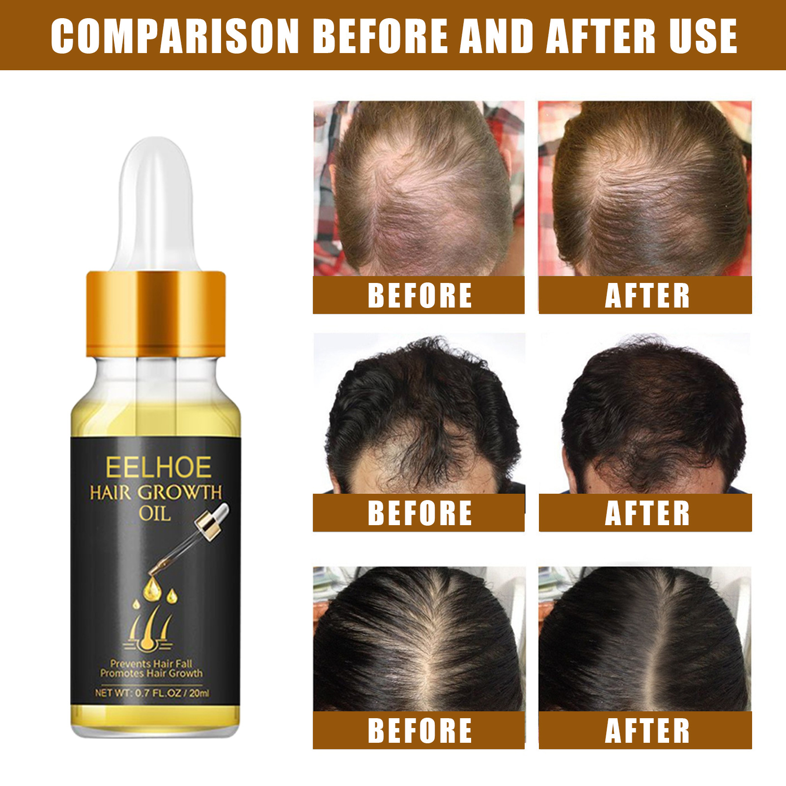 EELHOE Thick Hair Essence Ulei puternic de balsam pentru păr, netezește și hidratează părul, soluție nutritivă pentru păr gros_voghion.com