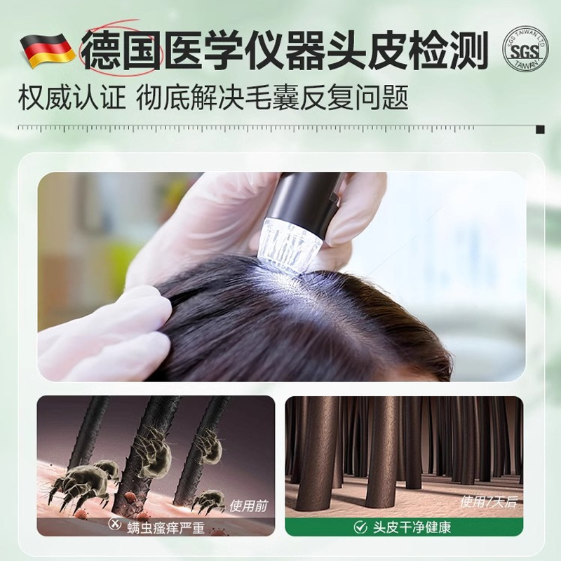 Ji Zhi Hui 二硫化セレン シャンプー ローション フケ防止シャンプー 毛包をきれいにし、かゆみを和らげ、オイルをコントロールします 大容量|undefined