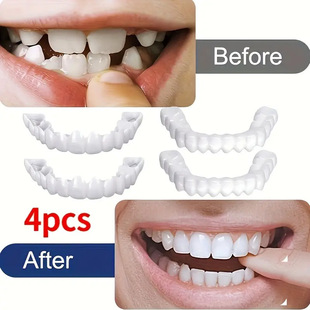 2025 New Cross-Border Dropshipping 4-Piece Set of Professional Dental Veneers Easy Cross-Border
