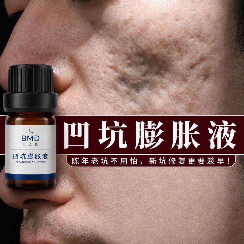 Acne Scar Growth Serum, Scar Repair Serum, Acne Scar Smoothing Serum, Scar Filling Essence, Skin Soothing Liquid Acne Scar Growth Serum, Scar Repair Serum, Acne Scar Smoothing Serum, Scar Filling Essence, Skin Soothing Liquid