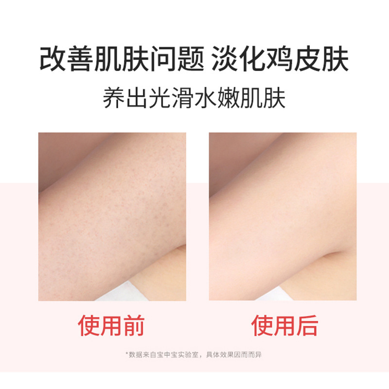 Bao Zhong Bao Urea Cream Chicken Skin Moisturizing Hydrating Anti-Dry Nourishing Skincare Body Lotion Hand Cream Foot Cream