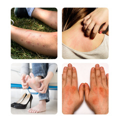 SF Direct Delivery, Manufacturer Directly Operated, Seven Poisons Skin Fresh Kang Cream Spray, Skin World Street Therapy, Wholesale Promotion, Lead Generation