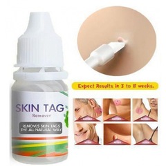 10ml スキンタグリムーバー いぼ治療 乳頭腫除去 クロスボーダー