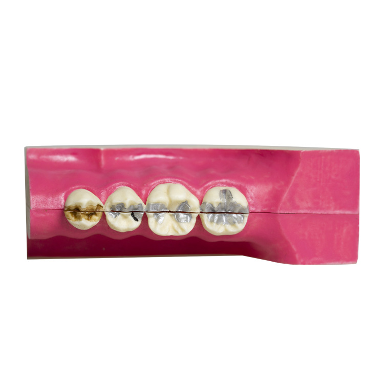 Modelo de descomposición del tejido del diente posterior inferior derecho de la cavidad oral del diente