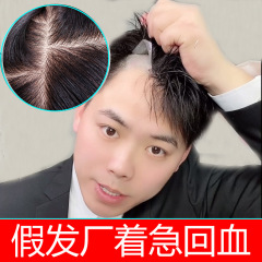 男性用かつら全手織りと針回し生物頭皮縁ハゲかつら地中海かつら男偽真髪