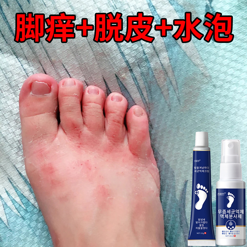 リクネンフットメディシンスプレーは、足の臭い、かゆみ、皮むけ、腐った足、汗ばむ足、かゆみ止め軟膏を除去します。|undefined
