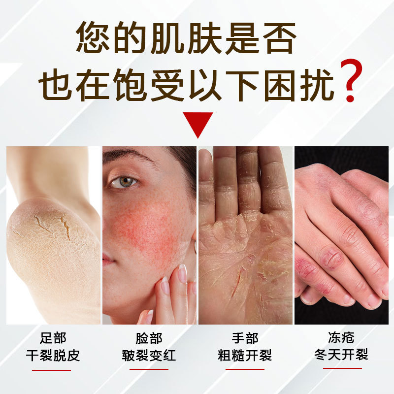 德国靡浩览娅马油皲裂膏手脚干裂粗糙疼痒护理膏冬季防冻滋润膏|undefined