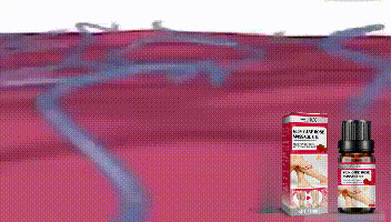 EELHOE Rose Venenpflege Ätherisches Öl Beinmassage Krampfadern Verbesserung der Durchblutung Lymphdrainage Beinpflege_voghion.com