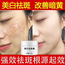 �������˪��Чȥ��ɫ��ȥ����ߕ��ȸ�߸��ư��S���׿������˪