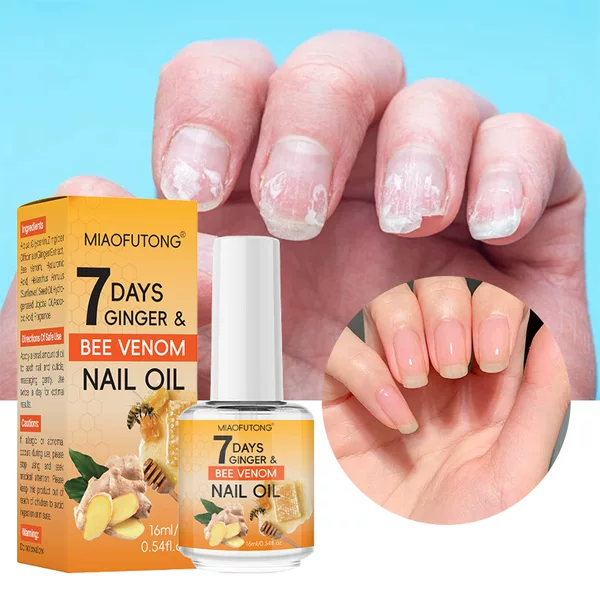 Cross-Border Exclusive Supply of 7 Days Turmeric Bee Venom Armor Oil for Fingers and Toes, Cuticle Nourishing and Repairing Finger Edge Nutrient Solution