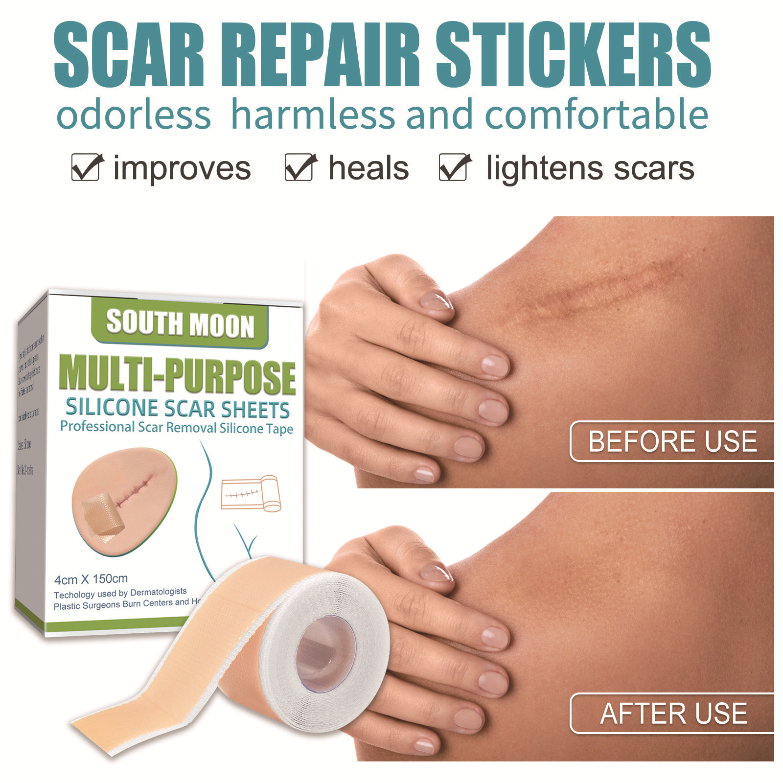 South Moon 硅凝膠傷疤貼 淡化修護皮膚妊娠平滑肌膚手術傷疤貼