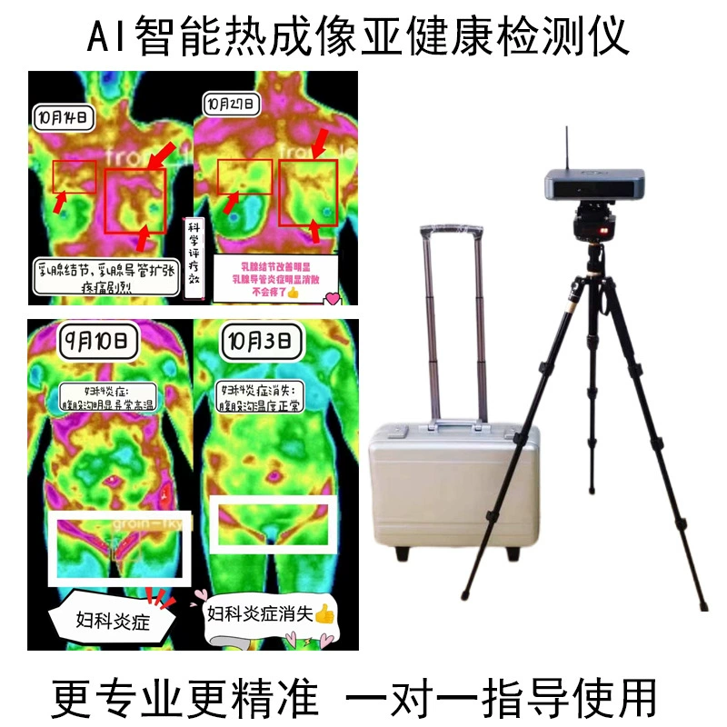 ИИ тепловизионный детектор здоровья проект всего тела Инфракрасный тепловизионный КТ прибор для физического обследования Здоровье Все-в-одном машина Традиционная китайская медицина