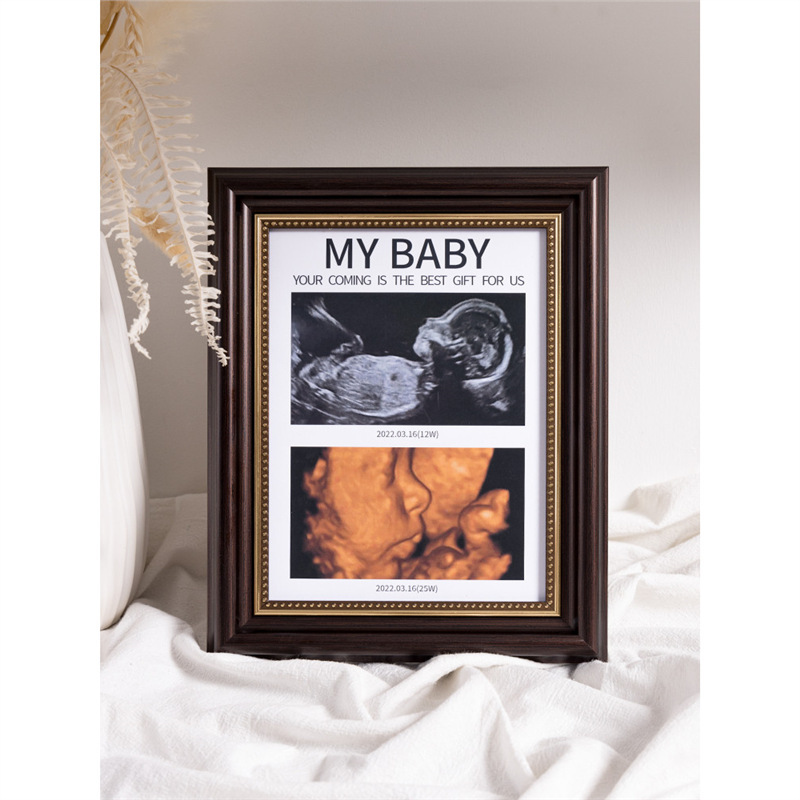 Baby 4D Photo Commemorative Frame Nt B-Ultrasound Image Color Ultrasound Print Pregnancy Newborn Baby Birth Gift Display Stand Baby 4D Photo Commemorative Frame Nt B-Ultrasound Image Color Ultrasound Print Pregnancy Newborn Baby Birth Gift Display Stand